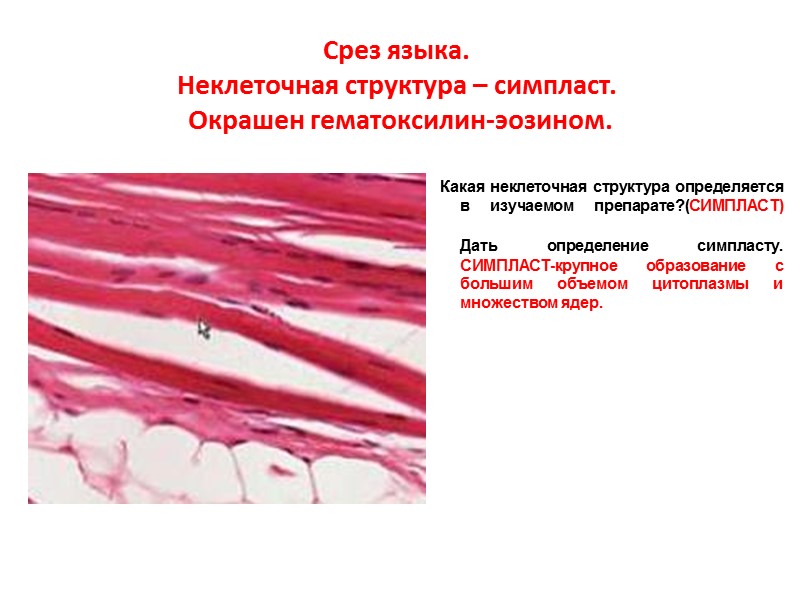 Срез языка. Неклеточная структура – симпласт.  Окрашен гематоксилин-эозином.  Какая неклеточная структура определяется